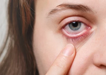 Glaucoma Clinic in pune